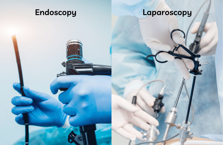 Major difference between laparoscopy and endoscopy surgery