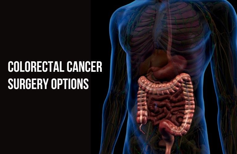 Surgical options for colorectal cancer