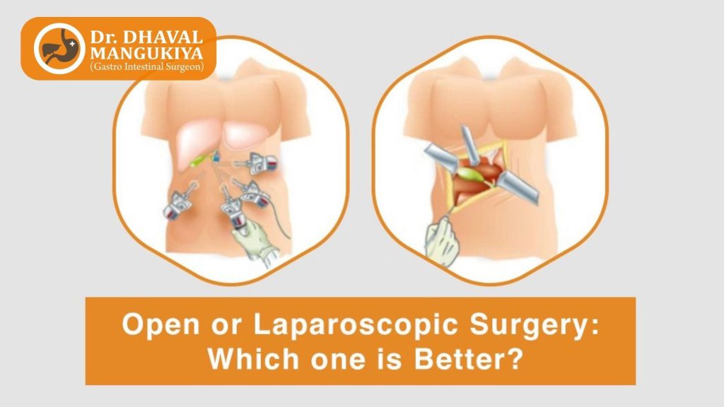 laparoscopic surgeons in Surat,