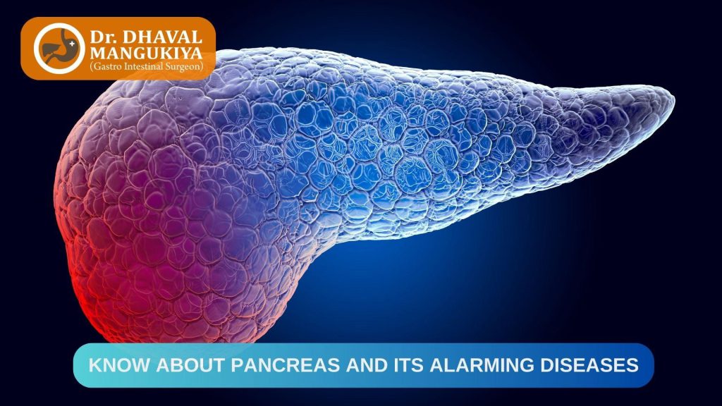 Pancreas Its Alarming Diseases