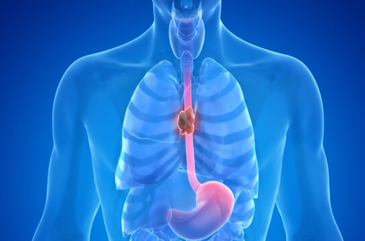 Esophagus